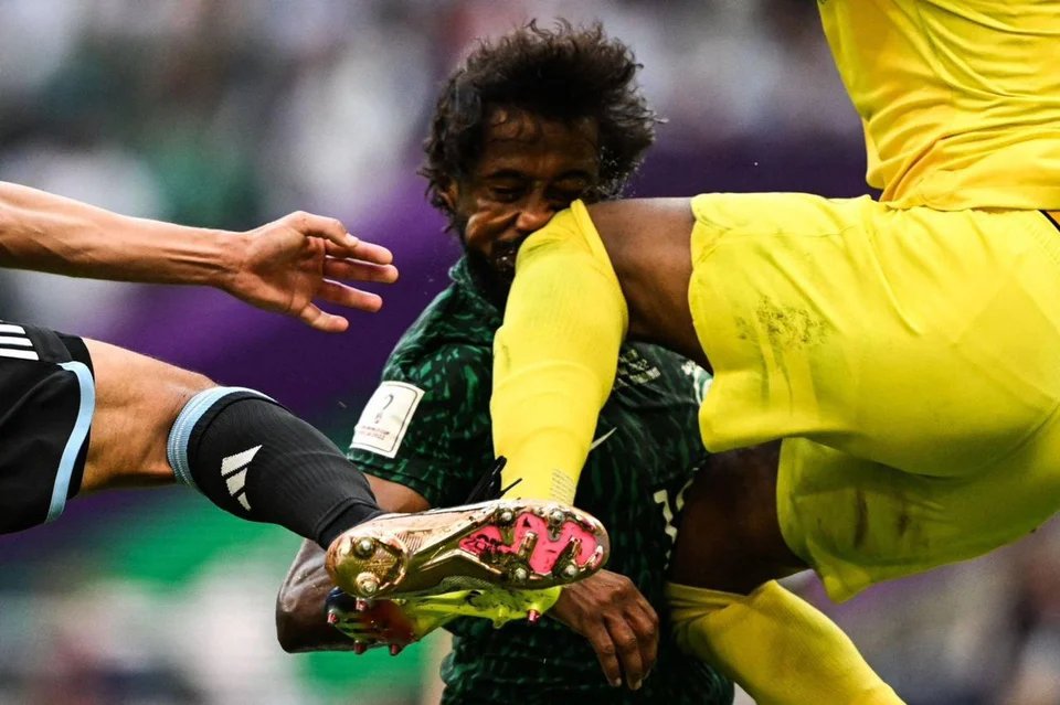 La terrible lesión del defensor de Arabia Saudita ante Argentina en Qatar